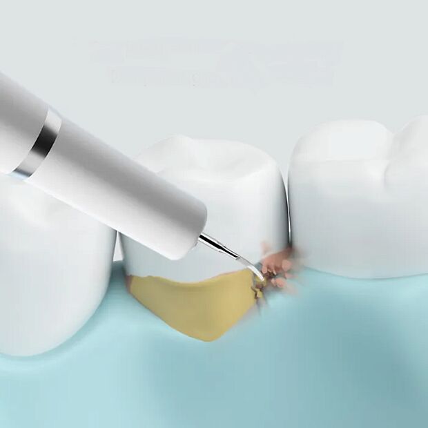 Прибор для удаления зубного камня Dr.Bei YC2, white - 5